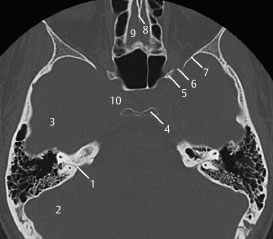 Radiologic Anatomy of the Skull Base | Radiology Key