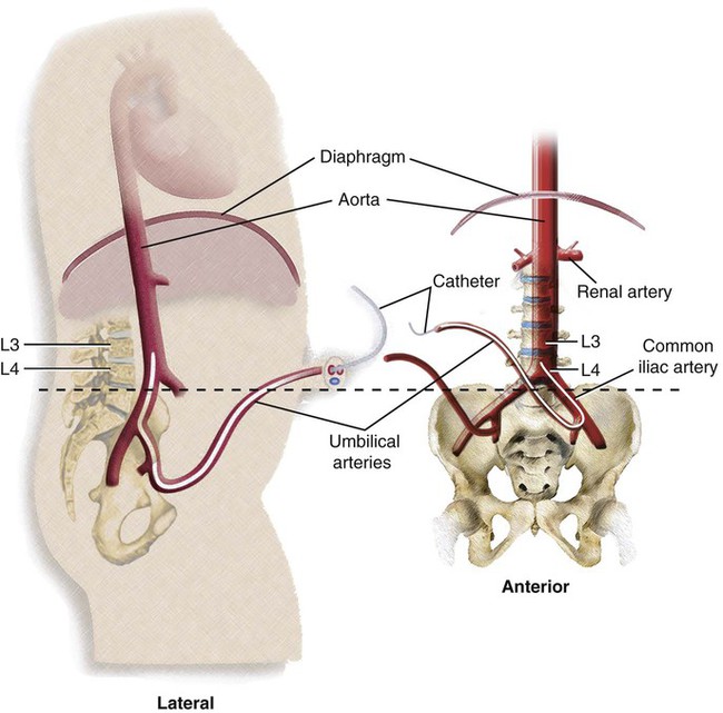 Vascular Anatomy of the Pelvis | Radiology Key