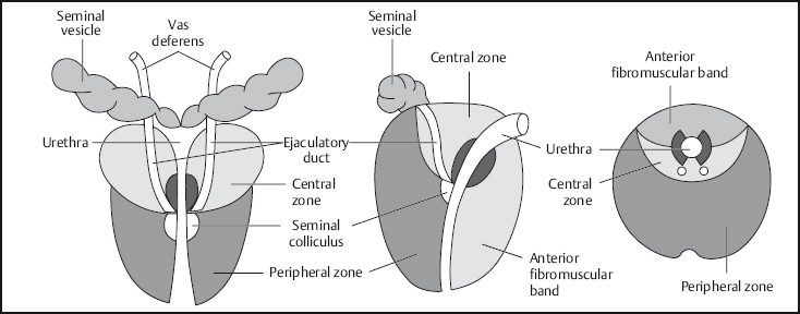 The Prostate And Seminal Vesicles Radiology Key
