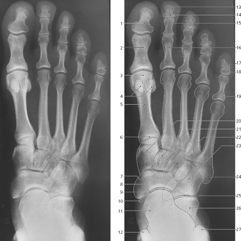 and Foot | Radiology Key