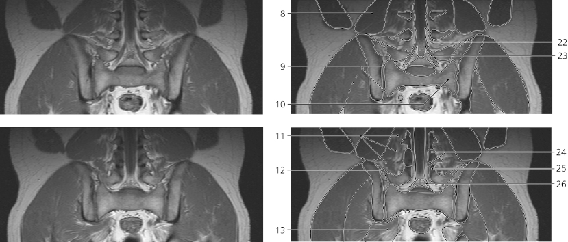 Spine Radiology Key