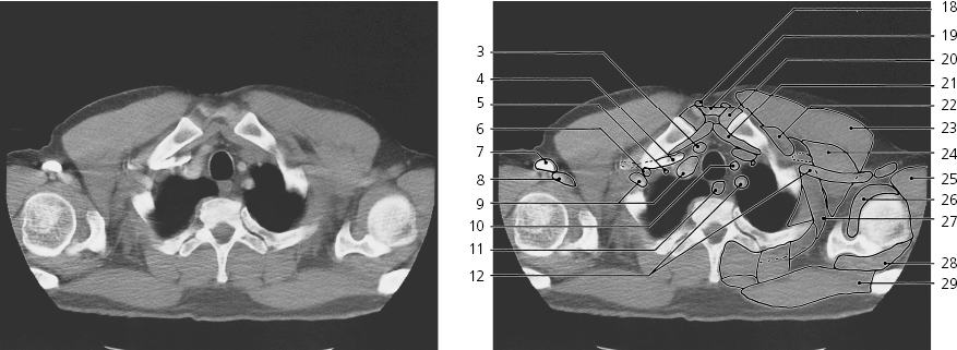 CT Series | Radiology Key