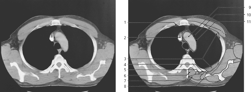 CT Series | Radiology Key