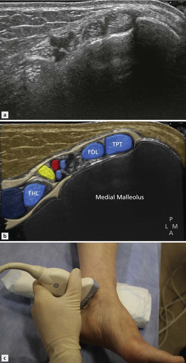 Ankle Joint and Forefoot: Anatomy and Techniques | Radiology Key
