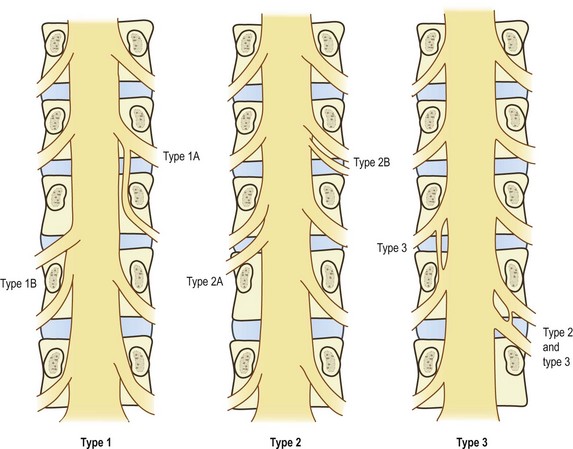 Nerves of the lumbar spine | Radiology Key