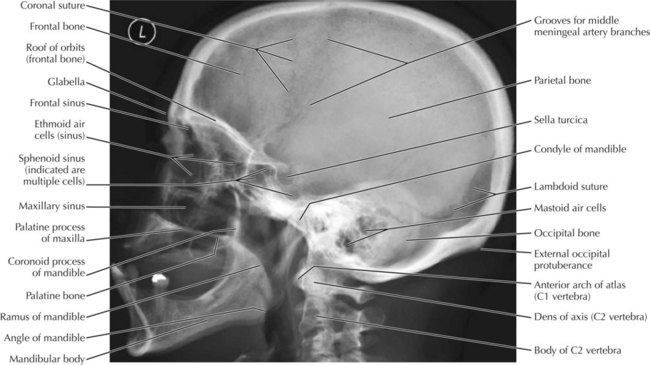 Head and Neck | Radiology Key