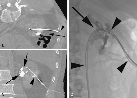 Urologic And Genital Systems Radiology Key