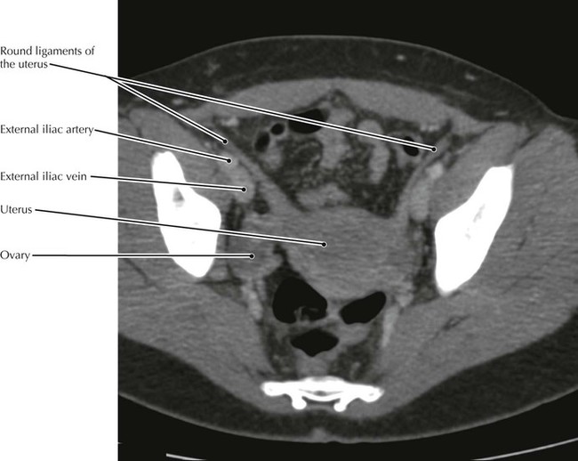 Pelvis And Perineum Radiology Key