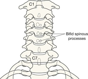 Cervical spine | Radiology Key