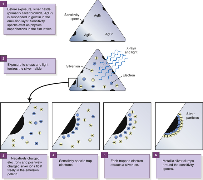 image-receptors-radiology-key