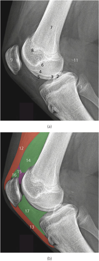 Knee | Radiology Key