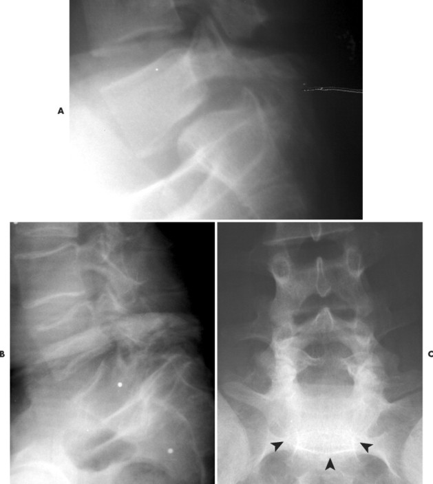 Trauma Radiology Key