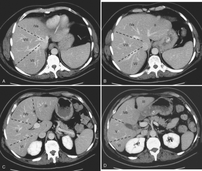 Liver | Radiology Key