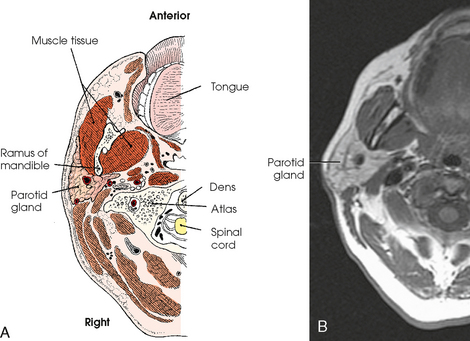 MOUTH AND SALIVARY GLANDS | Radiology Key