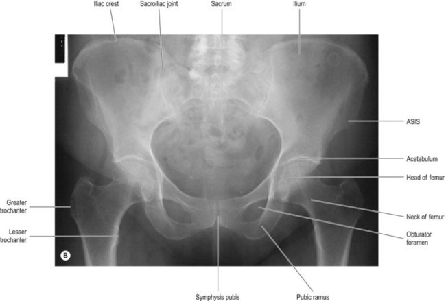Pelvis and hips | Radiology Key