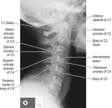 Cervical spine | Radiology Key