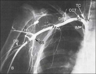 Arterial Anatomy of the Extremities | Radiology Key