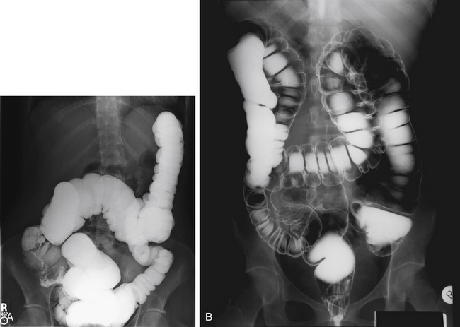 Contrast Media And Introduction To Radiopharmaceuticals Radiology Key
