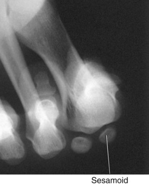 Lower Limb And Pelvis | Radiology Key