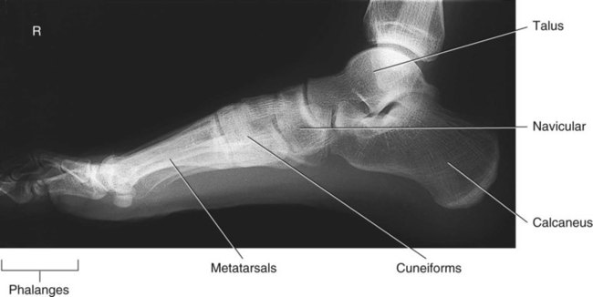 Lower Limb And Pelvis | Radiology Key