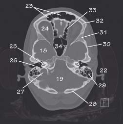 Head CT anatomy | Radiology Key