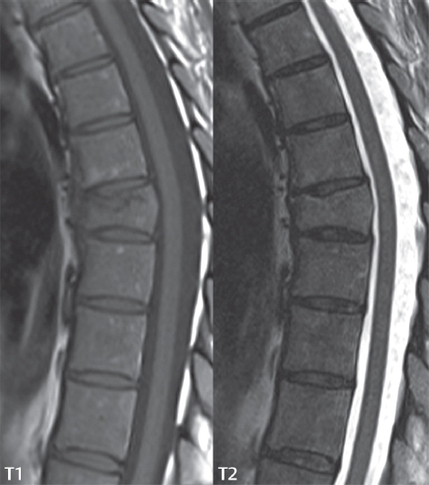 Spine Radiology Key