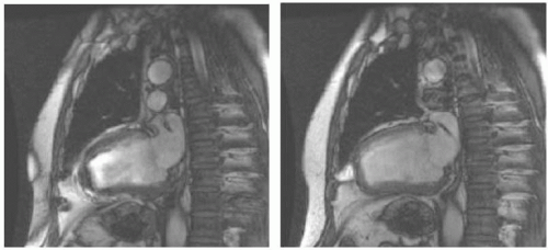 Artifacts Radiology Key