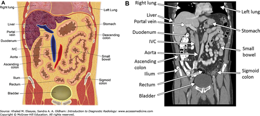 Gastrointestinal Imaging | Radiology Key