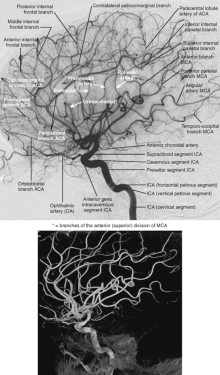 Clinical-Anatomical Syndromes of Ischemic Infarction | Radiology Key