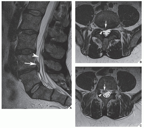 Spine Radiology Key