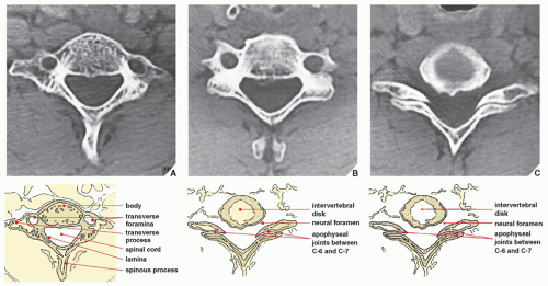 Spine | Radiology Key