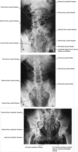 Lymphatic System Of The Abdomen And Pelvis Radiology Key