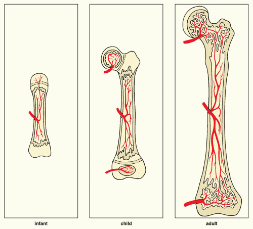 Radiologic Evaluation of Musculoskeletal Infections | Radiology Key