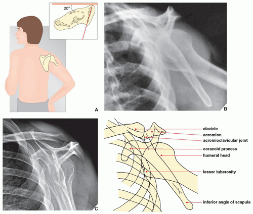 Upper Limb I: Shoulder Girdle | Radiology Key