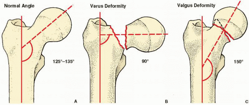 Lower Limb I: Pelvic Girdle And Proximal Femur | Radiology Key