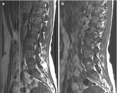 Spine Radiology Key