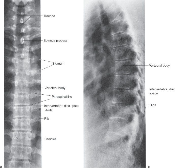 9 Spine and Pelvis | Radiology Key