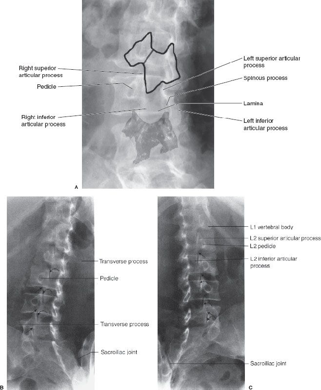9 Spine and Pelvis | Radiology Key