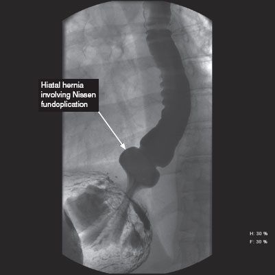 Esophagus Radiology Key