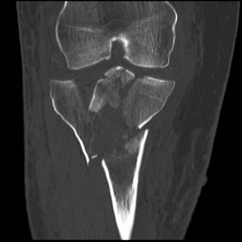 Pelvis And Hip Radiology Key