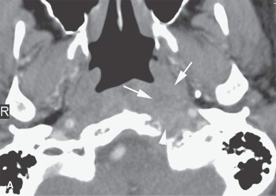 Imaging Guided Biopsy Radiology Key