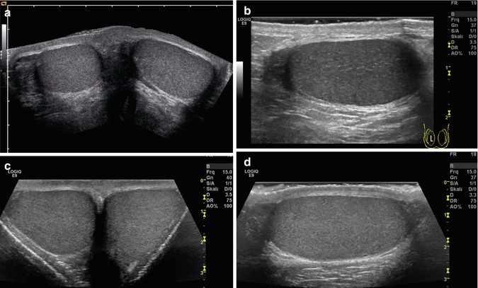 Doppler Sonography Of The Scrotum Radiology Key