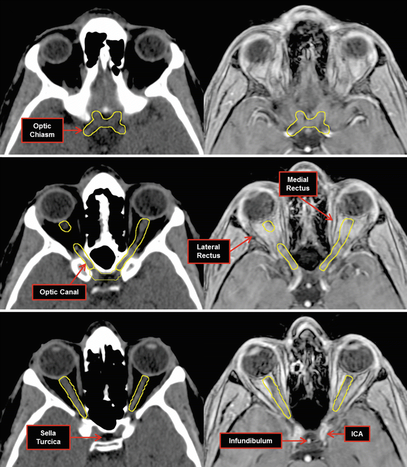 Nerves Radiology Key