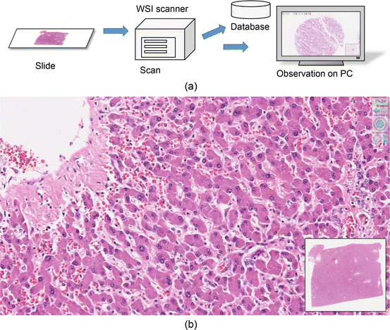 Breast cancer evaluation by fluorescent dot detection using combined  mathematical morphology and multifractal techniques, Diagnostic Pathology