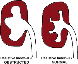 Urologic emergencies in pregnancy.