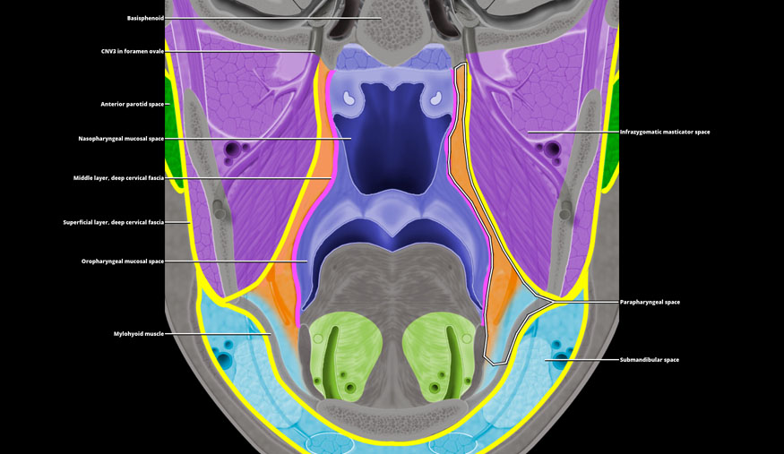 parapharyngeal space