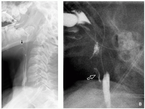 Gastrointestinal Tract Radiology Key