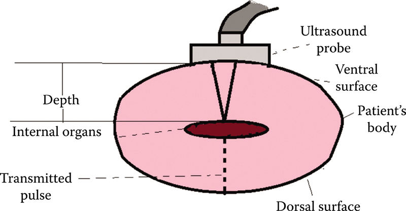 Ultrasound Physics Radiology Key