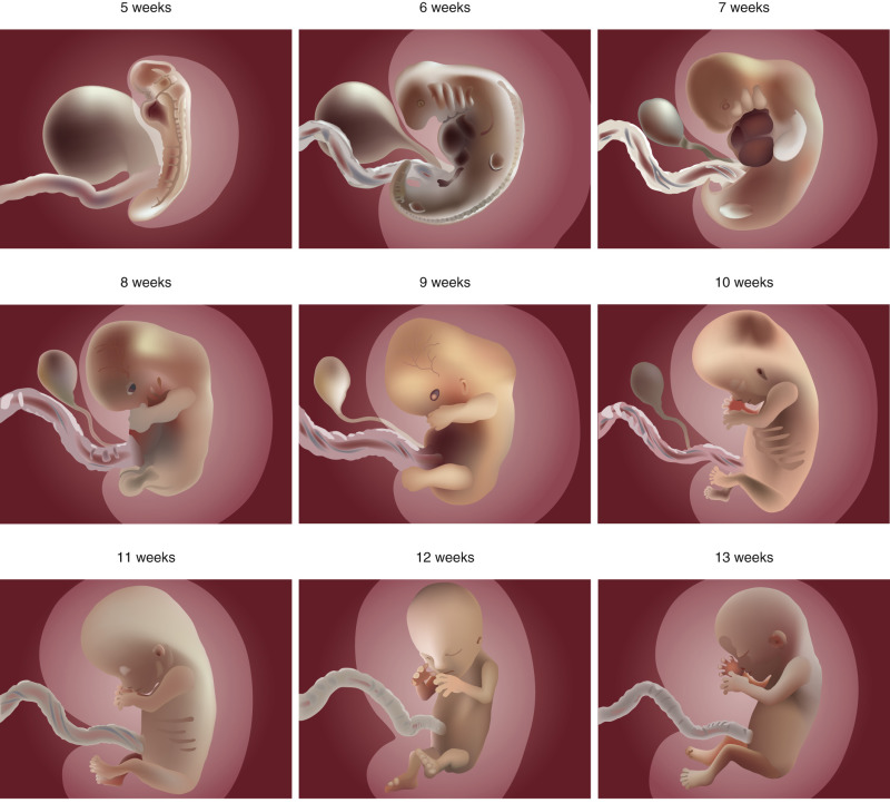 Evaluation of Fetal Anatomy in the First Trimester