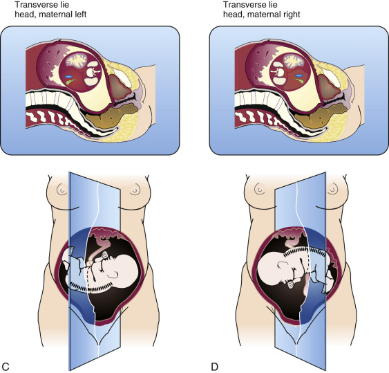 ultrasound-evaluation-of-normal-fetal-anatomy-radiology-key